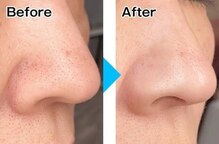 ドルフィン(DOLPHIN)