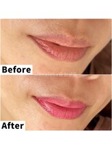 マハロハ 自由が丘(Mahaloha)/【唇ピンクトーン施術】