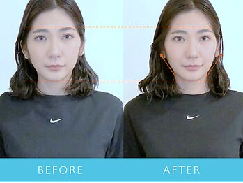 ビューティーマジック 恵比寿 広尾(beauty magic)/小顔矯正術 頭顔骨コース1回