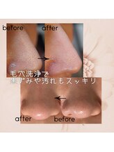 ララチッタ(L'la citta)/毛穴の汚れをスッキリ取り除く