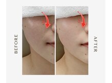 オーシャン(OCEAN)/ムートンホイップスパ