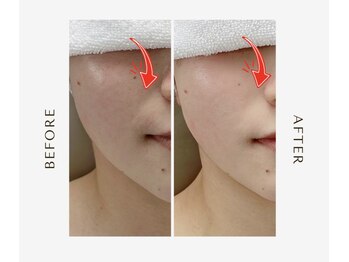 オーシャン(OCEAN)/ムートンホイップスパ