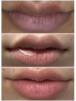 レイ(Rey)/リップローマピンクの変化 大阪