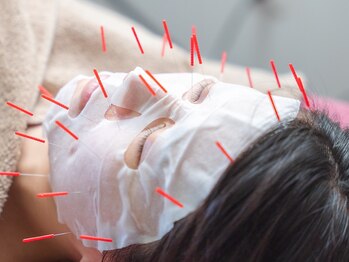 藤崎駅前整体院の写真/美容鍼（顔）＋エクソソーム美容パックのSET★美容成分の浸透率が上がる施術で効果満足度◎乾燥肌も改善！