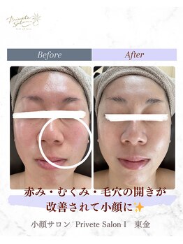 アイ(I)/肌状態に合ったお手入れをご提案