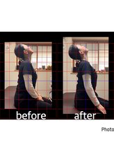 十六夜マッサージ/首の痛みに