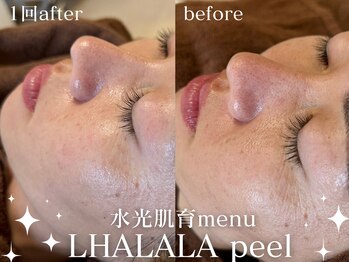 グランクウォーレ(Gran Cuore)/毛穴を引き締めたいなら★