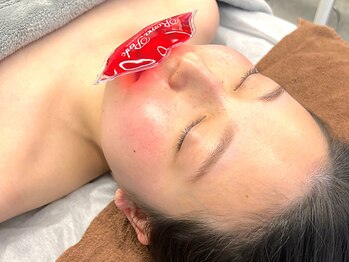 スパーブ(Superb)の写真/《ローマピンク》唇やバストなどの黒ずみを速攻ケア！プロのケアで黒ずみを改善し、綺麗なピンク色に♪