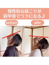 整体天使のはね 福山店/慢性的な肩こりがラクになる！