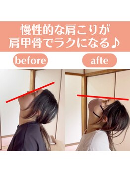 整体天使のはね 福山店/慢性的な肩こりがラクになる!