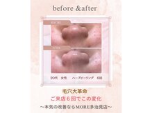 モア 多治見店(MORE)/お客様ビフォーアフター♪