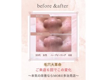 モア 多治見店(MORE)/お客様ビフォーアフター♪