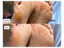 カシェット(Cachette)/60代女性◎足裏角質ケア90分