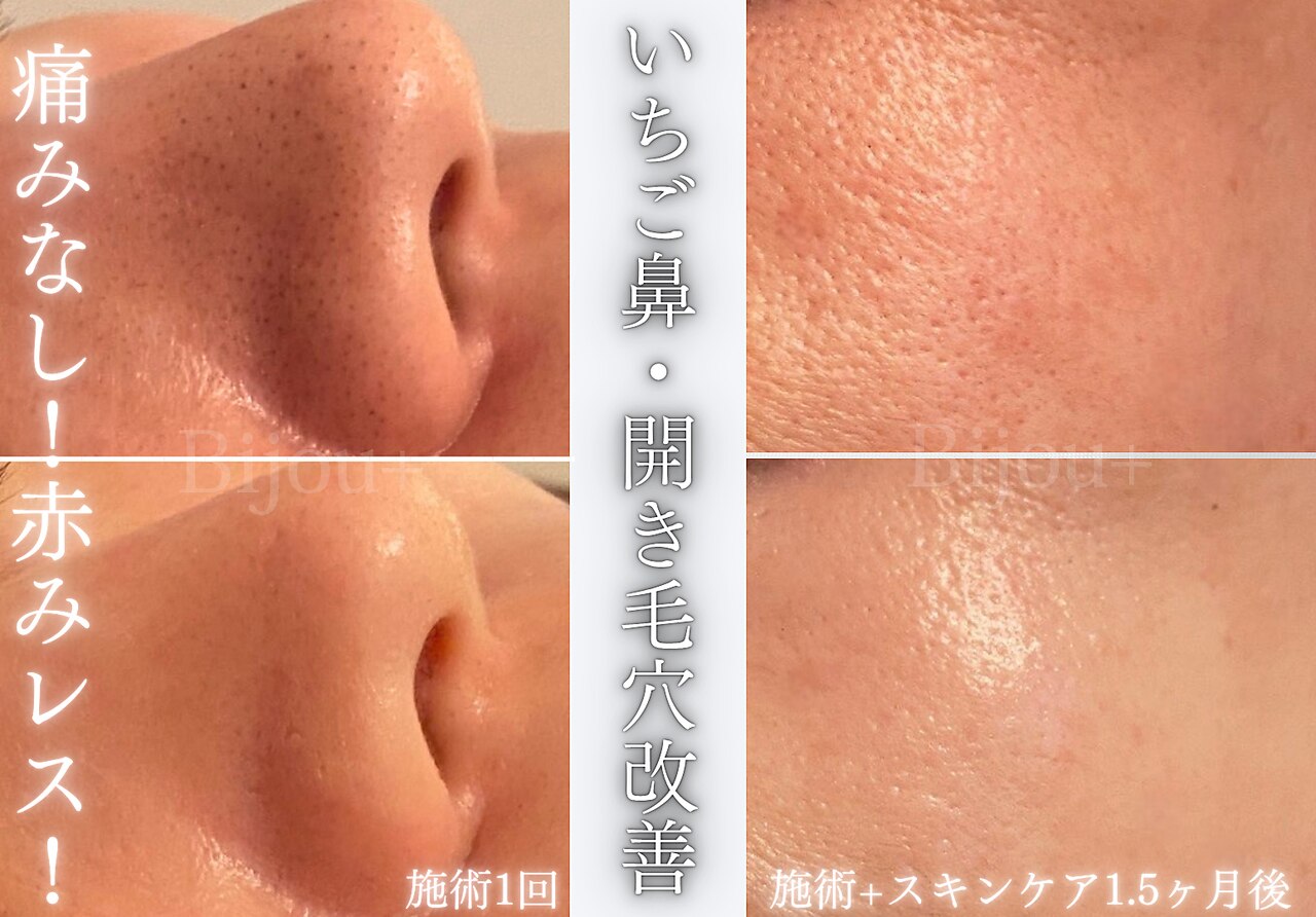 ビジュープラス 水戸店(Bijou+)｜ホットペッパービューティー