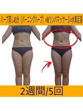 ヨサパーク マナ(YOSA PARK MANA)/痩身コース5回詰めて体験の結果!