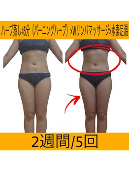 ヨサパーク マナ(YOSA PARK MANA)/痩身コース5回詰めて体験の結果!