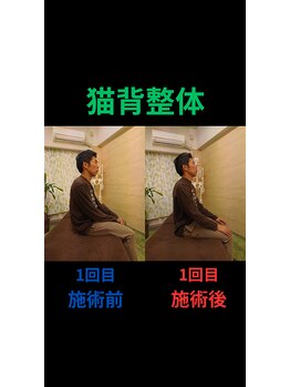 姿勢リカバリー 新宿店/猫背整体