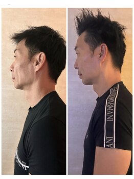 ハピネスエグゼ/６０分フェイスビフォーアフター