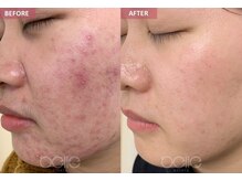 順蘭堂/肌質改善ケア