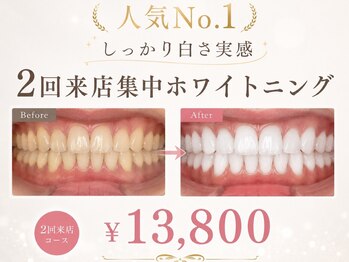 グリッター ショウナン(glitter. SHONAN)の写真/本気で歯を白くしたい方限定】2回来店集中ホワイトニング/藤沢ホワイトニング/ホワイトニング藤沢