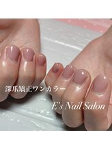 イーズ(E's)/深爪矯正ワンカラー