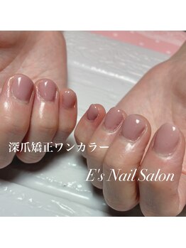 イーズ(E's)/深爪矯正ワンカラー