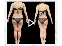 エステティック エイチアンドビー 大和店(H&B)/ビフォーアフター