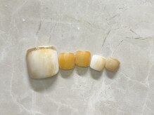 ジェイ(J)/フット定額コース