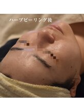 ココルーネ(COCORUNE)/シルク肌ハーブピーリング