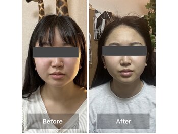 リノリー 仙台荒井店(rinory)/韓国式コルギ