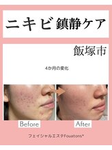 フワットン(Fouatons)/