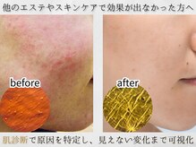 アンレミューラボ(Un Lemieux Labo)