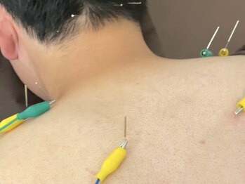 鍼灸 整体院 スズユ(SUZUYU)/【北浜/鍼灸/整体/肩こり改善】