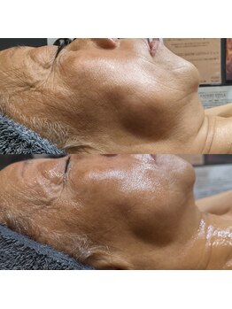 アルム(a'rme)/【たるみ】