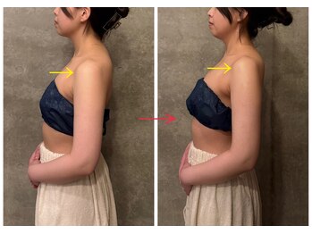 ビノワ(Binowa)/巻き肩が改善！！