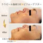 トトノウ(totonou)