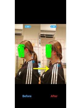 ふくろう整骨院/ビフォーアフター