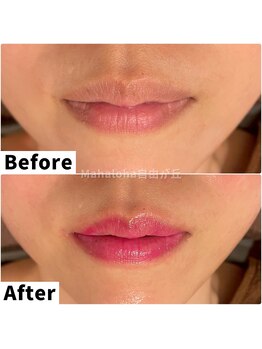 マハロハ 自由が丘(Mahaloha)/【唇ピンクトーン施術】