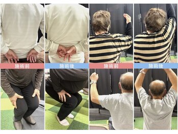 ナゴミ鍼灸 整体院(NAGOMI鍼灸 整体院)/ビフォーアフター