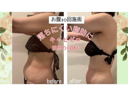 ギンザエクランの写真