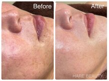 ハレビューティー 北千住(HARE BEAUTY.)の雰囲気（【韓国肌管理】色むら・シミ・毛穴の開き改善・透明感ある水光肌）