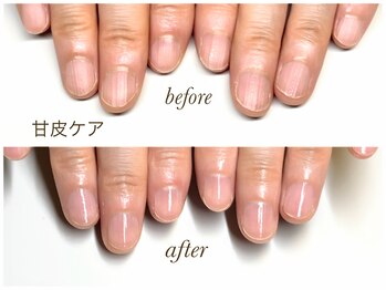 ロア(LOA)の写真/【人気の甘皮ケアコース☆￥5,500】ジェル/スカルプメニューには丁寧なウォーターケアがセット♪