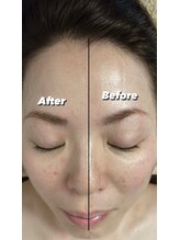 サファイア(sapphire)/小顔になる