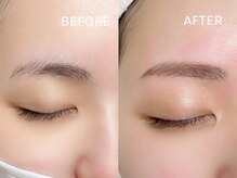 リュクス/ストレートアーチ