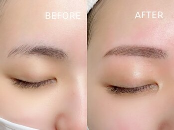 リュクス/ストレートアーチ