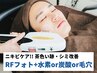 【茶色・シミ改善/ニキビケア】  RFフォト＋水素/炭酸/毛穴セレクトコース