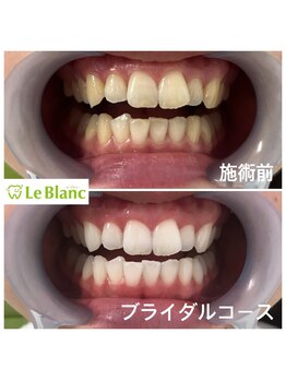 ルブラン 奈良店(Le Blanc)/ブライダルコース!!