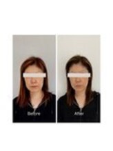 ハリラボ 仙台上杉店(hari Lab.)/【お客様の声】