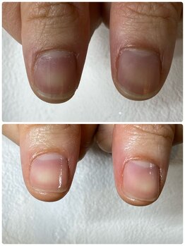 ネイルケア/ハンドケア/自爪育成