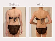 ソルム(SOLM)の雰囲気（天使の羽は当店にお任せ　セルゼロ／ブライダル/小顔コルギ）